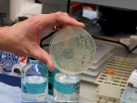 Bacteria growth petri dish